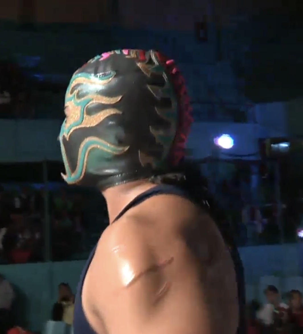 Titán left shoulder scar